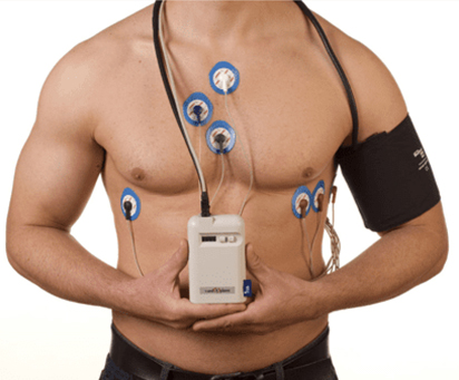 Holter cardiaco Civita Castellana