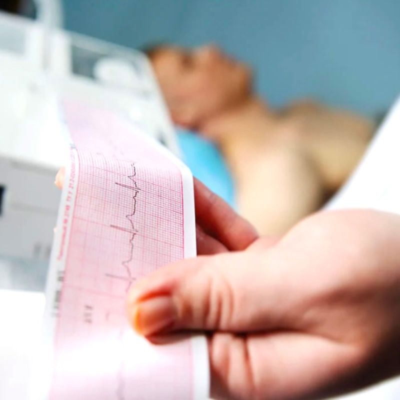 Elettrocardiogramma Civita Castellana Innova Smart Clinic